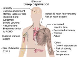 20145-sleep-effects_of_sleep_depr-huge
